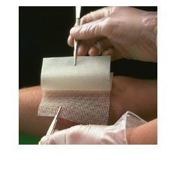 GARZA MEDICATA BACTIGRAS CON CLOREXIDINA ACETATO 0,5% 10X10CM 10 PEZZI - Farmadott.it